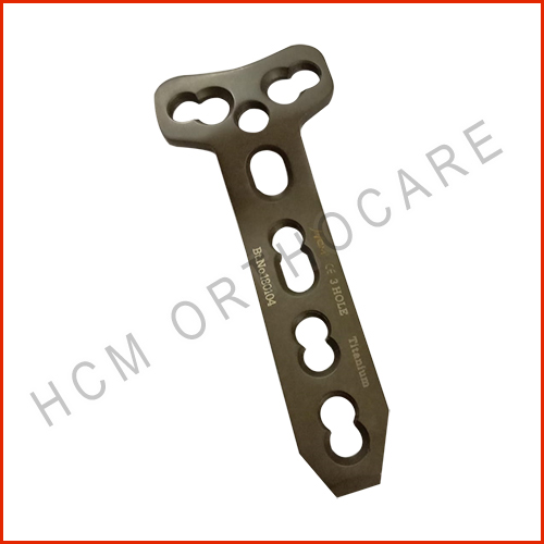 5.0-mm-buttress-locking-plate-