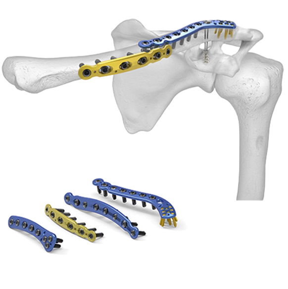 bone with screw image